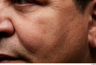 HD Face Skin Umberto Espinar cheek nose skin texture wrinkles…